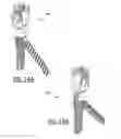 Fig. 16 - Supplemental fixation screw