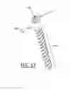 Fig. 19 - Supplemental fixation screw