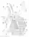Fig. 06 - Subcutaneous implantable device for gradually aligning a spine and subcutaneous implantable device for gradually lengthening a bone