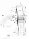 Fig. 09 - Subcutaneous implantable device for gradually aligning a spine and subcutaneous implantable device for gradually lengthening a bone