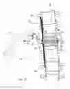 Fig. 10 - Subcutaneous implantable device for gradually aligning a spine and subcutaneous implantable device for gradually lengthening a bone