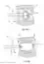 Fig. 16 - Subcutaneous implantable device for gradually aligning a spine and subcutaneous implantable device for gradually lengthening a bone