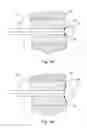 Fig. 18 - Subcutaneous implantable device for gradually aligning a spine and subcutaneous implantable device for gradually lengthening a bone