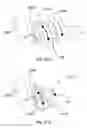 Fig. 24 - Subcutaneous implantable device for gradually aligning a spine and subcutaneous implantable device for gradually lengthening a bone