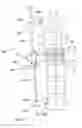 Fig. 26 - Subcutaneous implantable device for gradually aligning a spine and subcutaneous implantable device for gradually lengthening a bone