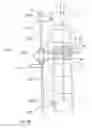 Fig. 27 - Subcutaneous implantable device for gradually aligning a spine and subcutaneous implantable device for gradually lengthening a bone