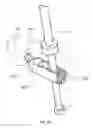 Fig. 29 - Subcutaneous implantable device for gradually aligning a spine and subcutaneous implantable device for gradually lengthening a bone
