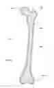 Fig. 33 - Subcutaneous implantable device for gradually aligning a spine and subcutaneous implantable device for gradually lengthening a bone