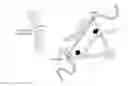 Fig. 01 - Techniques for reduction of basilar invagination and atlanto axial dislocation and surgical instruments thereof