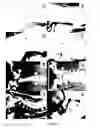 Fig. 06 - Techniques for reduction of basilar invagination and atlanto axial dislocation and surgical instruments thereof