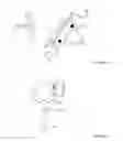 Fig. 10 - Techniques for reduction of basilar invagination and atlanto axial dislocation and surgical instruments thereof