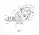 Fig. 02 - SURGICAL IMPLANT SYSTEM AND METHOD
