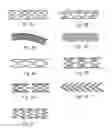 Fig. 04 - Bone stabilization device and method