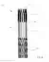 Fig. 05 - Bone stabilization device and method