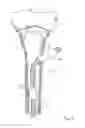 Fig. 08 - Bone stabilization device and method