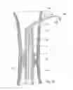 Fig. 19 - Bone stabilization device and method