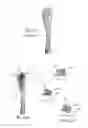 Fig. 10 - Osteotomy plate for long bones
