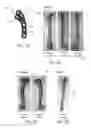 Fig. 11 - Osteotomy plate for long bones