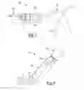 Fig. 06 - METHOD AND APPARATUS FOR DELIVERY OF BONE CEMENT