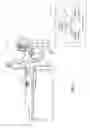 Fig. 06 - Irrigated ablation catheter with sensor array