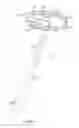 Fig. 03 - Catheter with adjustable arcuate distal section