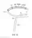 Fig. 12 - Catheter with adjustable arcuate distal section
