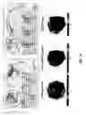 Fig. 14 - System and method for Decrement EvokEd Potential (DEEP) mapping to identify components of the arrythmogenic circuit in cardiac arrhythmias