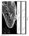 Fig. 15 - System and method for Decrement EvokEd Potential (DEEP) mapping to identify components of the arrythmogenic circuit in cardiac arrhythmias