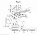 Fig. 08 - System for image-based robotic surgery