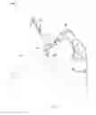 Fig. 03 - Notched apparatus for guidance of an insertable instrument along an axis during spinal surgery