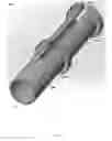 Fig. 04 - Notched apparatus for guidance of an insertable instrument along an axis during spinal surgery