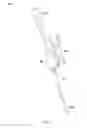 Fig. 07 - Notched apparatus for guidance of an insertable instrument along an axis during spinal surgery