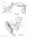 Fig. 05 - Curved cannula surgical system