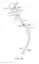 Fig. 07 - Curved cannula surgical system