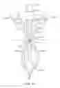 Fig. 09 - Curved cannula surgical system