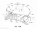 Fig. 32 - Curved cannula surgical system