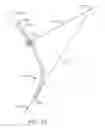 Fig. 40 - Curved cannula surgical system