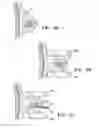 Fig. 06 - IMAGEABLE BIOPSY SITE MARKER
