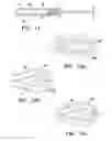 Fig. 10 - IMAGEABLE BIOPSY SITE MARKER