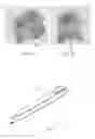 Fig. 05 - Radio frequency identification capsule (RFID)