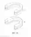 Fig. 04 - CLEAR ALIGNER MANUFACTURING METHOD AND CLEAR ALIGNER SO MANUFACTURED
