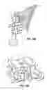 Fig. 04 - SELF-LIGATING ORTHODONTIC BRACKET