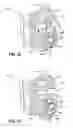 Fig. 08 - ORTHODONTIC BRACKET HAVING A LINGUALLY BIASED CLOSURE MEMBER AND ASSOCIATED METHOD
