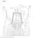 Fig. 01 - Prosthodontic device with detachable suprastructure and related screw