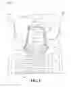 Fig. 02 - Prosthodontic device with detachable suprastructure and related screw