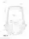 Fig. 06 - Prosthodontic device with detachable suprastructure and related screw