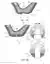 Fig. 09 - GUIDED SINUS LIFT