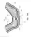 Fig. 17 - GUIDED SINUS LIFT