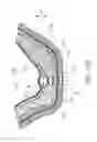Fig. 18 - GUIDED SINUS LIFT
