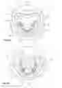 Fig. 02 - Prosthetic preform for producing a dental prosthetic body